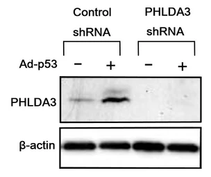 Anti-PHLDA3 antibody [4B6] used in Western Blot (WB). GTX00700