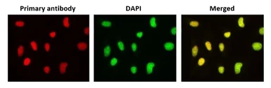 Anti-PHLDA3 antibody [4B6] used in Immunocytochemistry/ Immunofluorescence (ICC/IF). GTX00700