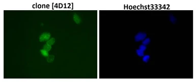 Anti-SUMO1 antibody [4D12] used in Immunocytochemistry/ Immunofluorescence (ICC/IF). GTX00701