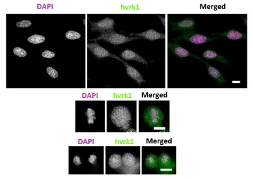 Anti-VRK1 antibody [5D1] used in Immunocytochemistry/ Immunofluorescence (ICC/IF). GTX00703