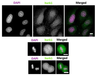 Anti-VRK1 antibody [5D1] used in Immunocytochemistry/ Immunofluorescence (ICC/IF). GTX00703