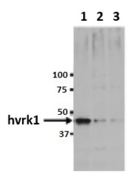 Anti-VRK1 antibody [5D1] used in Western Blot (WB). GTX00703