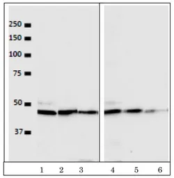 Anti-VRK1 antibody [5D1] used in Western Blot (WB). GTX00703
