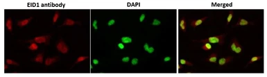 Anti-EID1 antibody [2] used in Immunocytochemistry/ Immunofluorescence (ICC/IF). GTX00708
