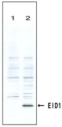 Anti-EID1 antibody [2] used in Western Blot (WB). GTX00708