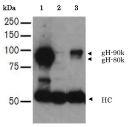 Anti-Herpes virus 7 gH antibody [2] used in Immunoprecipitation (IP). GTX00709