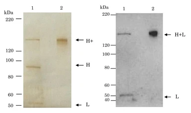 Anti-Clostridium tetani Tetanus toxin antibody [TH-11] used in Western Blot (WB). GTX00715