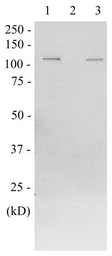 Anti-beta Galactosidase antibody used in Western Blot (WB). GTX00718