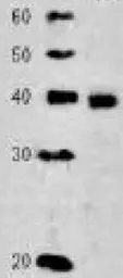 Anti-Rad51 antibody used in Western Blot (WB). GTX00719