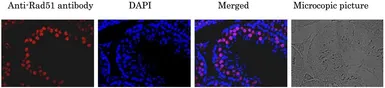Anti-Rad51 antibody used in IHC (Paraffin sections) (IHC-P). GTX00720