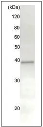 Anti-Rad51 antibody used in Immunoprecipitation (IP). GTX00720