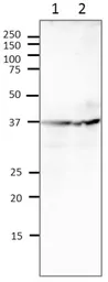 Anti-Rad51 antibody used in Western Blot (WB). GTX00720