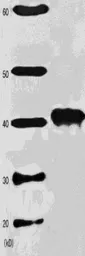 Anti-Rad51 antibody used in Western Blot (WB). GTX00721