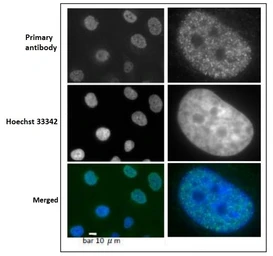 Anti-PCNA antibody used in Immunocytochemistry/ Immunofluorescence (ICC/IF). GTX00723