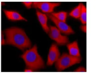 Anti-DDX3 antibody used in Immunocytochemistry/ Immunofluorescence (ICC/IF). GTX00724