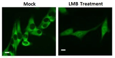 Anti-DDX3 antibody used in Immunocytochemistry/ Immunofluorescence (ICC/IF). GTX00724
