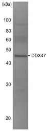 Anti-DDX47 antibody used in Western Blot (WB). GTX00726