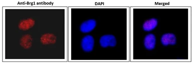 Anti-BRG1 antibody used in Immunocytochemistry/ Immunofluorescence (ICC/IF). GTX00727