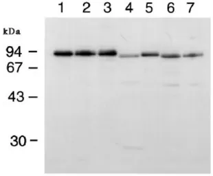 Anti-RanBP9 antibody used in Western Blot (WB). GTX00728