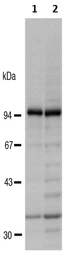 Anti-RanBP9 antibody used in Western Blot (WB). GTX00728