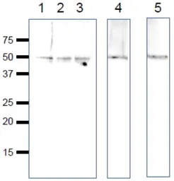 Anti-Rag C antibody used in Western Blot (WB). GTX00731