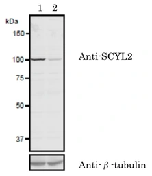 Anti-SCYL2 antibody used in Western Blot (WB). GTX00732