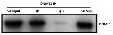 Anti-DNMT1 antibody used in Immunoprecipitation (IP). GTX00734