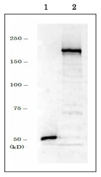 Anti-DNMT1 antibody used in Western Blot (WB). GTX00734