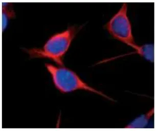 Anti-Nestin antibody used in Immunocytochemistry/ Immunofluorescence (ICC/IF). GTX00737