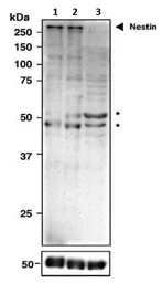 Anti-Nestin antibody used in Western Blot (WB). GTX00737