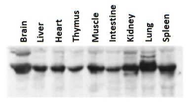 Anti-NUCB2 antibody used in Western Blot (WB). GTX00739