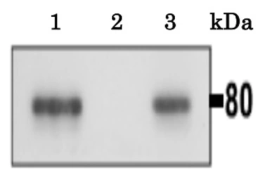 Anti-CLGN antibody used in Immunoprecipitation (IP). GTX00744