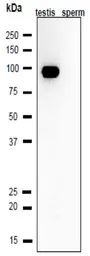 Anti-CLGN antibody used in Western Blot (WB). GTX00744
