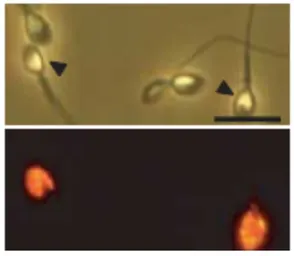 Anti-IZUMO1 antibody used in Immunocytochemistry/ Immunofluorescence (ICC/IF). GTX00746
