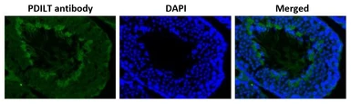 Anti-PDILT antibody used in IHC (Paraffin sections) (IHC-P). GTX00747