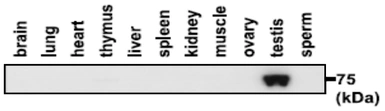 Anti-PDILT antibody used in Western Blot (WB). GTX00747