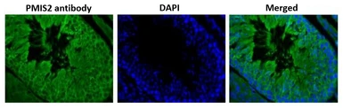 Anti-PMIS2 antibody used in IHC (Paraffin sections) (IHC-P). GTX00748