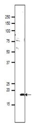 Anti-PMIS2 antibody used in Western Blot (WB). GTX00748
