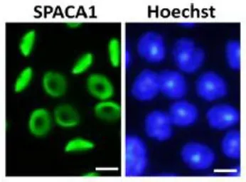 Anti-SPACA1 antibody used in Immunocytochemistry/ Immunofluorescence (ICC/IF). GTX00749