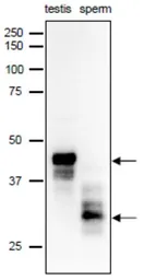 Anti-SPACA1 antibody used in Western Blot (WB). GTX00749