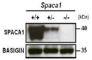 Anti-SPACA1 antibody used in Western Blot (WB). GTX00749