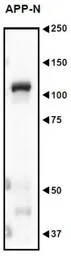 Anti-APP antibody used in Western Blot (WB). GTX00753