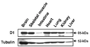 Anti-MAGED1 antibody used in Western Blot (WB). GTX00754