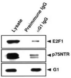 Anti-MAGEG1 antibody used in Immunoprecipitation (IP). GTX00755