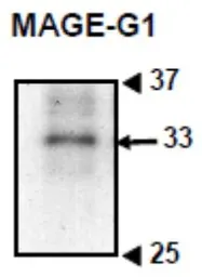 Anti-MAGEG1 antibody used in Western Blot (WB). GTX00755
