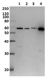 Anti-Diphtheria Toxin antibody used in Western Blot (WB). GTX00757