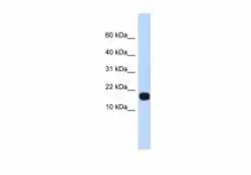 Anti-ID4 antibody used in Western Blot (WB). GTX00771