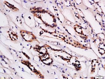Anti-STRA6 antibody used in IHC (Paraffin sections) (IHC-P). GTX00772