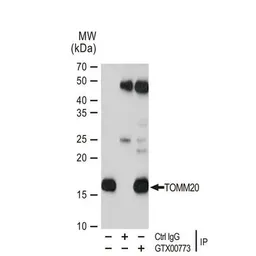 Anti-TOMM20 antibody [GT1136] used in Immunoprecipitation (IP). GTX00773