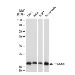 Anti-TOMM20 antibody [GT1136] used in Western Blot (WB). GTX00773